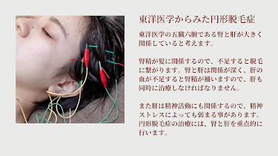 Shibuyaarufa Acupuncture 사진 3