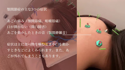Shibuyaarufa Acupuncture 사진 2