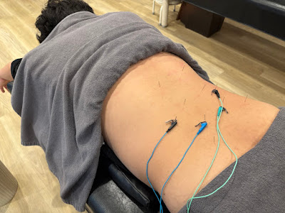 F . C . C Tsukijishinkyu Acupuncture 사진 3