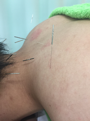 Nishikasai Ekimae Asahiroshinkyu Orthopedic Clinic 사진 4