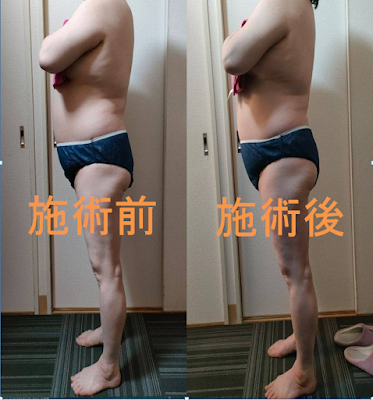 ベラルーチェ 사진 4