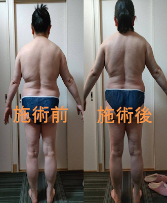 ベラルーチェ 사진 5