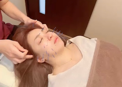 Miraiseikotsuin Acupuncture 사진 5