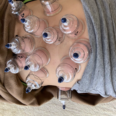 Kusumoto Acupuncture 사진 5