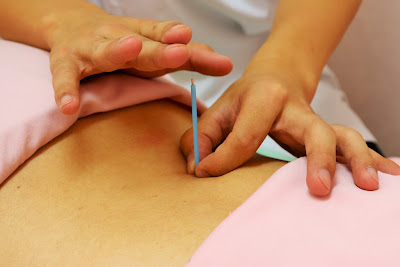 Sasazuka Sakura Acupuncture & Seitai 사진 4
