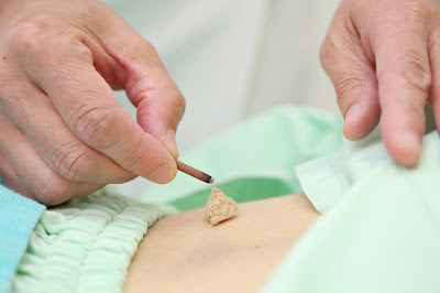Genkido Massage Harikyu Acupuncture 사진 2