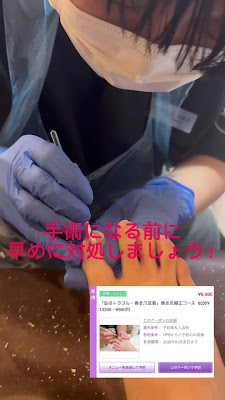 巻き爪サロンnicori門前仲町（江東区 門前仲町 茅場町） 사진 4
