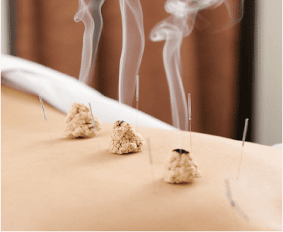 Ekichikashinkyuinmassajiin Acupuncture 사진 5