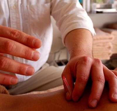 ​三助堂鍼療院 Sansukedou Acupuncture Massage 사진 4