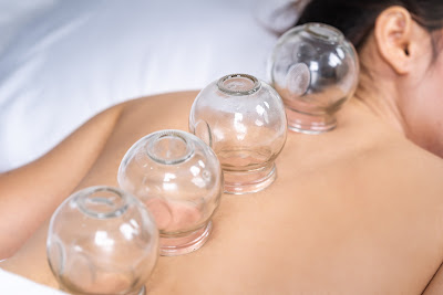OLA Acupuncture 사진 5