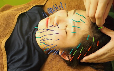 Karadashifuto Acupuncture 사진 3