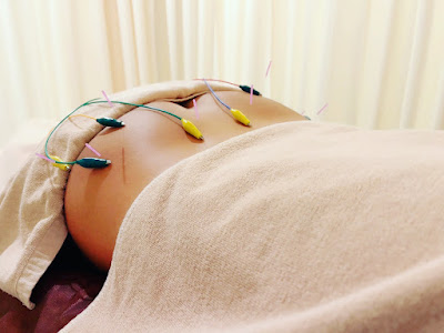 茶ノ木鍼灸院 【日本橋人形町/インディバ/鍼灸治療/マッサージ】INDIBA Acupuncture clinic 사진 3