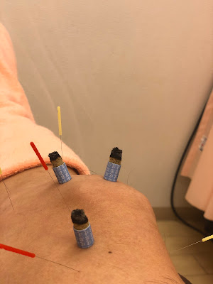 Naritahigashihogarakaharikyuin Acupuncture 사진 5