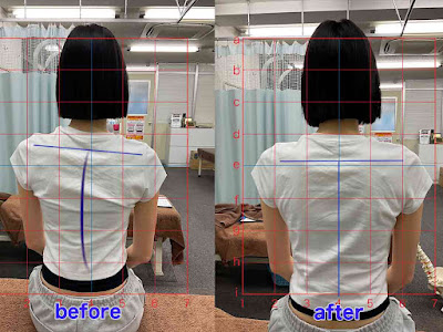Nakashin Acupuncture 사진 4