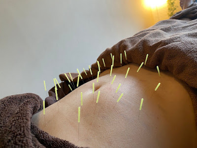 Kawabatashinkyu Massage Clinic 사진 3