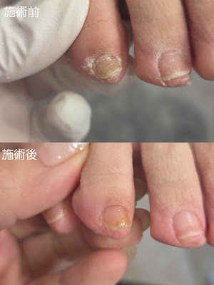 巻き爪 足爪ケア専門サロン HALUETO 사진 2