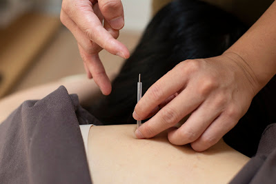 Aoinoha Acupuncture 사진 3
