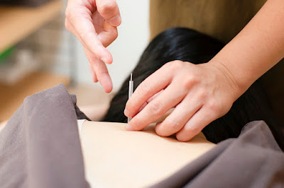 Aoinoha Acupuncture 사진 2