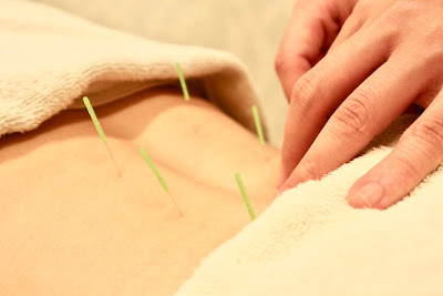 Ogikubo Kirin Do Acupuncture Orthopedic Clinic 사진 4