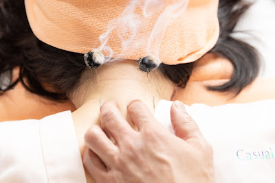 Casual Shiatsu Acupuncture 사진 5