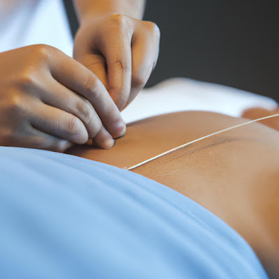 TC Lab Acupuncture 사진 4