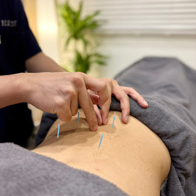 Iidabashi Ekimae Shinkyu Acupuncture 사진 4