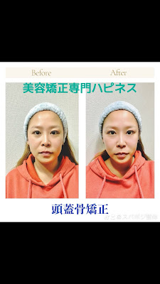 美容矯正専門 ハピネス 사진 2