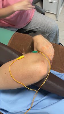 [English Speaking] FUJI 鍼灸院 | Fuji Wellness Acupuncture in Tokyo | Viện Châm Cứu tại Tokyo 사진 2