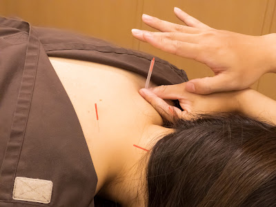 Shinozaki Ekimae Musubiseikotsuin Acupuncture 사진 3