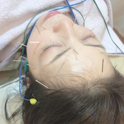 しろくま鍼灸整骨院 사진 4
