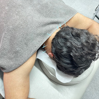 鍼灸院・整骨院ティップ 春日院 사진 2