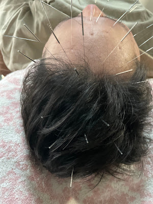 Nezunohariyu Acupuncture 사진 2