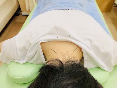 Asagaoshinkyu Acupuncture 사진 5