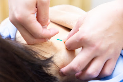 Mikazukiharikyu Clinic 사진 5