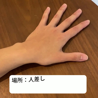ReBOOT Shinkyu Acupuncture 사진 3