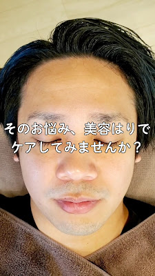 ReBOOT Shinkyu Acupuncture 사진 2