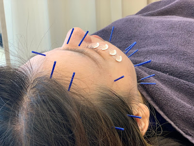 Shiinamachi Kitaguchi Acupuncture Orthopedic Clinic 사진 5