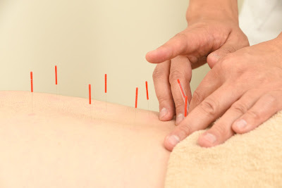 Ichikawa Ekimae Harikyu Acupuncture 사진 5