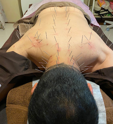 ひらみ鍼灸院練馬 사진 2
