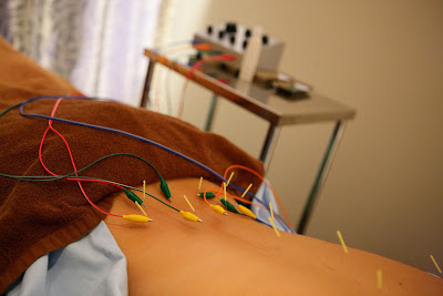 Sayan Acupuncture Orthopedic Clinic 사진 5