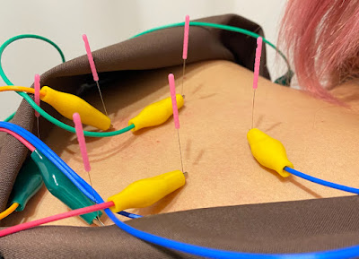 Komagometeikukeashinkyu Acupuncture 사진 4