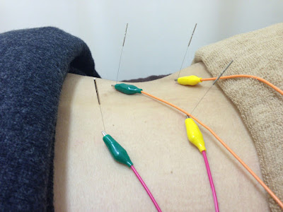 Komagomesuzuranshinkyu Orthopedic Clinic 사진 5
