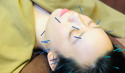 GAIA Acupuncture 사진 4