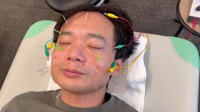 Tabatashincho Acupuncture Orthopedic Clinic 사진 2