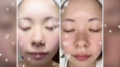 トータルビューティ＆ボディケアサロンwell -being 大泉学園 毛穴洗浄・ハーブピーリング専門フェイシャルサロン 사진 2