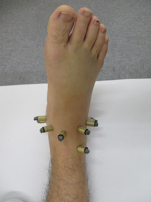 Hikari Acupuncture 사진 5