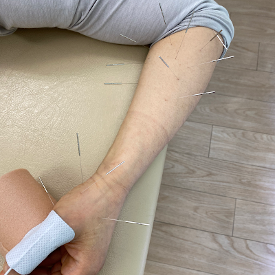 Jujoyotsubasetsu Acupuncture 사진 4