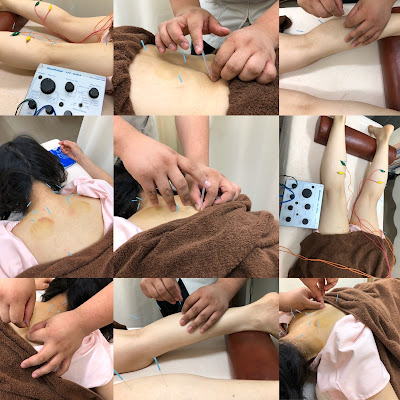 Kameari Ekimae Acupuncture 사진 5