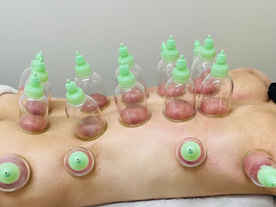 Motohasunumarikabashinkyu Acupuncture 사진 3
