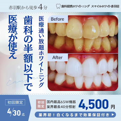 医療提携ホワイトニング スマイルホワイト 赤羽店 사진 3